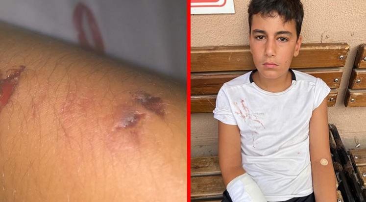 12 yaşındaki Alper'i esnaf kurtardı