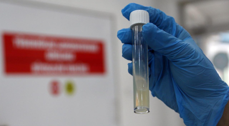 Tüberküloz hastalarına yakın takip